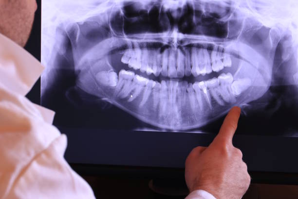 Best Root Canal Emergency Dentist  in Russellville, KY