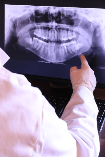 Best Teeth Whitening  in Russellville, KY