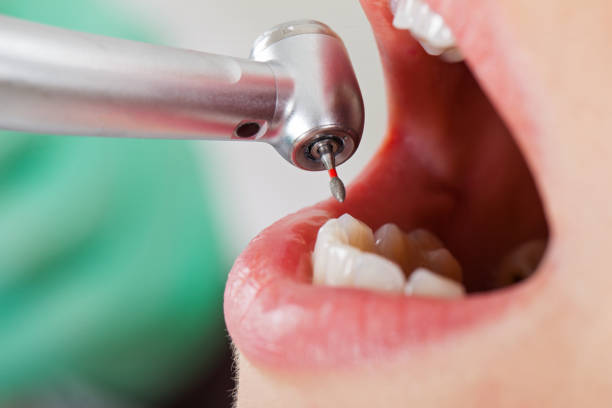 Best Emergency Dental Filling Replacement  in Russellville, KY